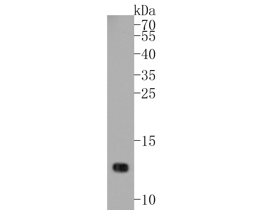 Western blot analysis of MGST1 on zebrafish tissue lysates. Proteins were transferred to a PVDF membrane and blocked with 5% BSA in PBS for 1 hour at room temperature. The primary antibody (EM1901-13, 1/500) was used in 5% BSA at room temperature for 2 hours. Goat Anti-Rabbit IgG - HRP Secondary Antibody (HA1001) at 1:5,000 dilution was used for 1 hour at room temperature.