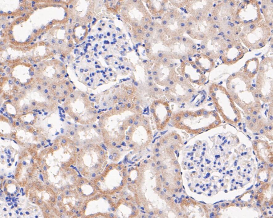 Immunohistochemical analysis of paraffin-embedded rat kidney tissue using anti-MGST1 antibody. The section was pre-treated using heat mediated antigen retrieval with Tris-EDTA buffer (pH 8.0-8.4) for 20 minutes.The tissues were blocked in 5% BSA for 30 minutes at room temperature, washed with ddH2O and PBS, and then probed with the primary antibody (EM1901-13, 1/50) for 30 minutes at room temperature. The detection was performed using an HRP conjugated compact polymer system. DAB was used as the chromogen. Tissues were counterstained with hematoxylin and mounted with DPX.