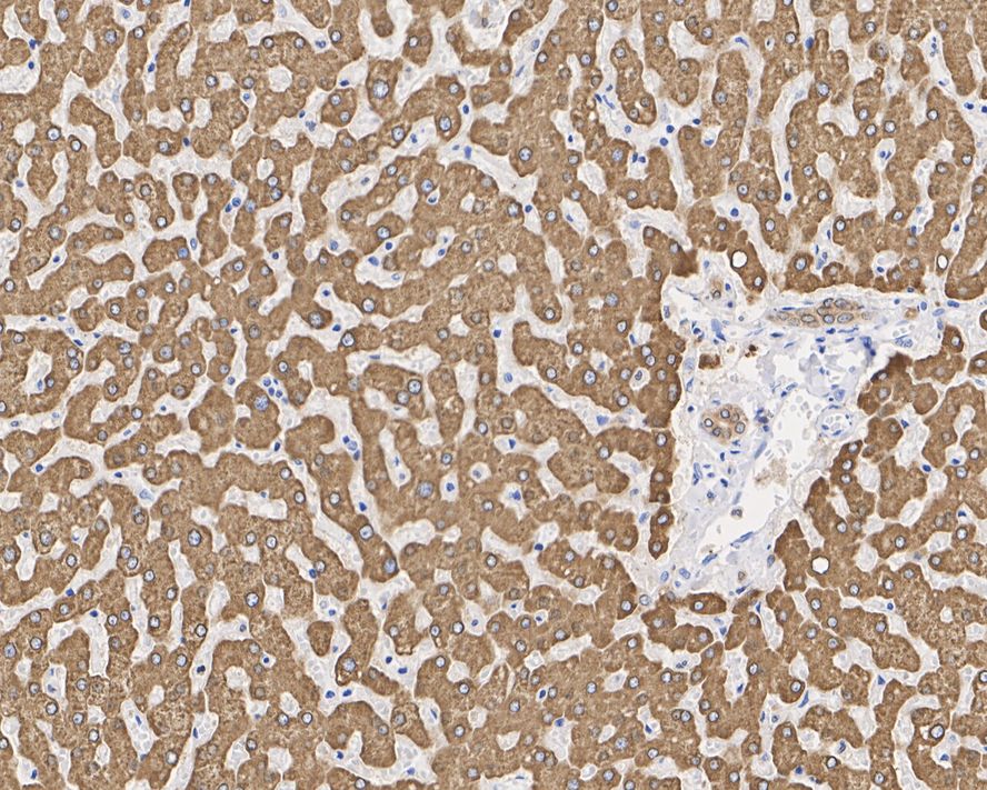 Immunohistochemical analysis of paraffin-embedded human placenta tissue using anti-MGST1 antibody. The section was pre-treated using heat mediated antigen retrieval with Tris-EDTA buffer (pH 8.0-8.4) for 20 minutes.The tissues were blocked in 5% BSA for 30 minutes at room temperature, washed with ddH2O and PBS, and then probed with the primary antibody (EM1901-13, 1/50) for 30 minutes at room temperature. The detection was performed using an HRP conjugated compact polymer system. DAB was used as the chromogen. Tissues were counterstained with hematoxylin and mounted with DPX.