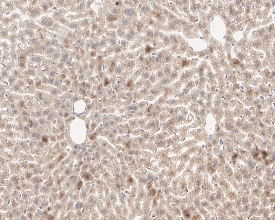 Immunohistochemical analysis of paraffin-embedded mouse liver tissue using anti-MGST1 antibody. The section was pre-treated using heat mediated antigen retrieval with Tris-EDTA buffer (pH 8.0-8.4) for 20 minutes.The tissues were blocked in 5% BSA for 30 minutes at room temperature, washed with ddH2O and PBS, and then probed with the primary antibody (EM1901-13, 1/50) for 30 minutes at room temperature. The detection was performed using an HRP conjugated compact polymer system. DAB was used as the chromogen. Tissues were counterstained with hematoxylin and mounted with DPX.