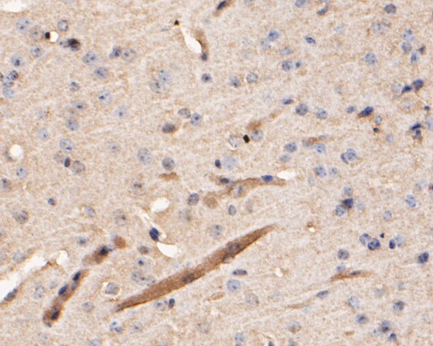 Immunohistochemical analysis of paraffin-embedded mouse brain tissue using anti-Cathepsin D antibody. The section was pre-treated using heat mediated antigen retrieval with Tris-EDTA buffer (pH 8.0-8.4) for 20 minutes.The tissues were blocked in 5% BSA for 30 minutes at room temperature, washed with ddH2O and PBS, and then probed with the primary antibody (EM1901-15, 1/50) for 30 minutes at room temperature. The detection was performed using an HRP conjugated compact polymer system. DAB was used as the chromogen. Tissues were counterstained with hematoxylin and mounted with DPX.