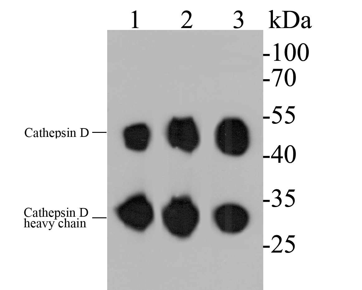 Western blot analysis of Cathepsin D on different lysates. Proteins were transferred to a PVDF membrane and blocked with 5% BSA in PBS for 1 hour at room temperature. The primary antibody (EM1901-16, 1/500) was used in 5% BSA at room temperature for 2 hours. Goat Anti-Mouse IgG - HRP Secondary Antibody (HA1006) at 1:5,000 dilution was used for 1 hour at room temperature.<br />
Positive control: <br />
Lane 1: SK-Br-3 cell lysate<br />
Lane 2: MCF-7 cell lysate<br />
Lane 3: U937 cell lysate