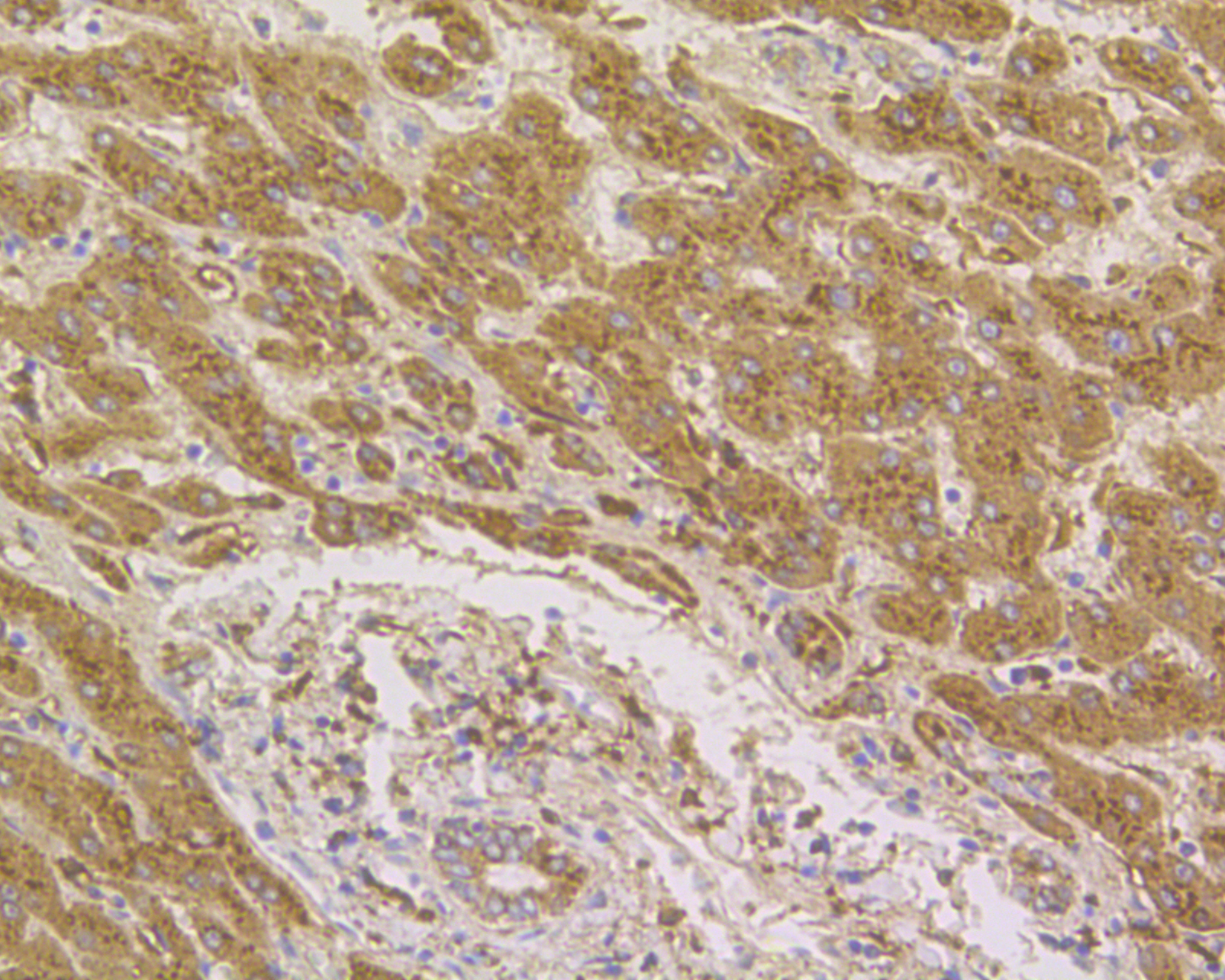 Immunohistochemical analysis of paraffin-embedded human liver tissue using anti-Cathepsin D antibody. The section was pre-treated using heat mediated antigen retrieval with Tris-EDTA buffer (pH 8.0-8.4) for 20 minutes.The tissues were blocked in 5% BSA for 30 minutes at room temperature, washed with ddH2O and PBS, and then probed with the primary antibody (EM1901-16, 1/50) for 30 minutes at room temperature. The detection was performed using an HRP conjugated compact polymer system. DAB was used as the chromogen. Tissues were counterstained with hematoxylin and mounted with DPX.