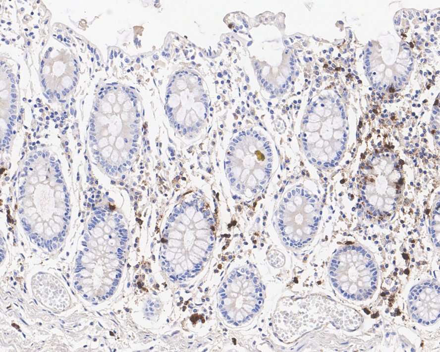 Immunohistochemical analysis of paraffin-embedded human tonsil tissue using anti-Myeloperoxidase antibody. The section was pre-treated using heat mediated antigen retrieval with Tris-EDTA buffer (pH 8.0-8.4) for 20 minutes.The tissues were blocked in 5% BSA for 30 minutes at room temperature, washed with ddH2O and PBS, and then probed with the primary antibody (EM1901-19, 1/50) for 30 minutes at room temperature. The detection was performed using an HRP conjugated compact polymer system. DAB was used as the chromogen. Tissues were counterstained with hematoxylin and mounted with DPX.