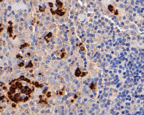 Immunohistochemical analysis of paraffin-embedded human tonsil tissue using anti-Myeloperoxidase antibody. The section was pre-treated using heat mediated antigen retrieval with Tris-EDTA buffer (pH 8.0-8.4) for 20 minutes.The tissues were blocked in 5% BSA for 30 minutes at room temperature, washed with ddH2O and PBS, and then probed with the primary antibody (EM1901-20, 1/50) for 30 minutes at room temperature. The detection was performed using an HRP conjugated compact polymer system. DAB was used as the chromogen. Tissues were counterstained with hematoxylin and mounted with DPX.
