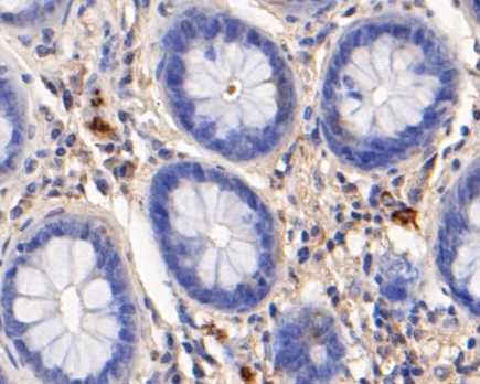 Immunohistochemical analysis of paraffin-embedded human colon tissue using anti-Myeloperoxidase antibody. The section was pre-treated using heat mediated antigen retrieval with Tris-EDTA buffer (pH 8.0-8.4) for 20 minutes.The tissues were blocked in 5% BSA for 30 minutes at room temperature, washed with ddH2O and PBS, and then probed with the primary antibody (EM1901-20, 1/50) for 30 minutes at room temperature. The detection was performed using an HRP conjugated compact polymer system. DAB was used as the chromogen. Tissues were counterstained with hematoxylin and mounted with DPX.