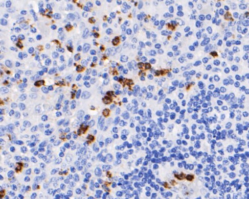 Immunohistochemical analysis of paraffin-embedded human tonsil tissue using anti-Myeloperoxidase antibody. The section was pre-treated using heat mediated antigen retrieval with Tris-EDTA buffer (pH 8.0-8.4) for 20 minutes.The tissues were blocked in 5% BSA for 30 minutes at room temperature, washed with ddH2O and PBS, and then probed with the primary antibody (EM1901-21, 1/200) for 30 minutes at room temperature. The detection was performed using an HRP conjugated compact polymer system. DAB was used as the chromogen. Tissues were counterstained with hematoxylin and mounted with DPX.