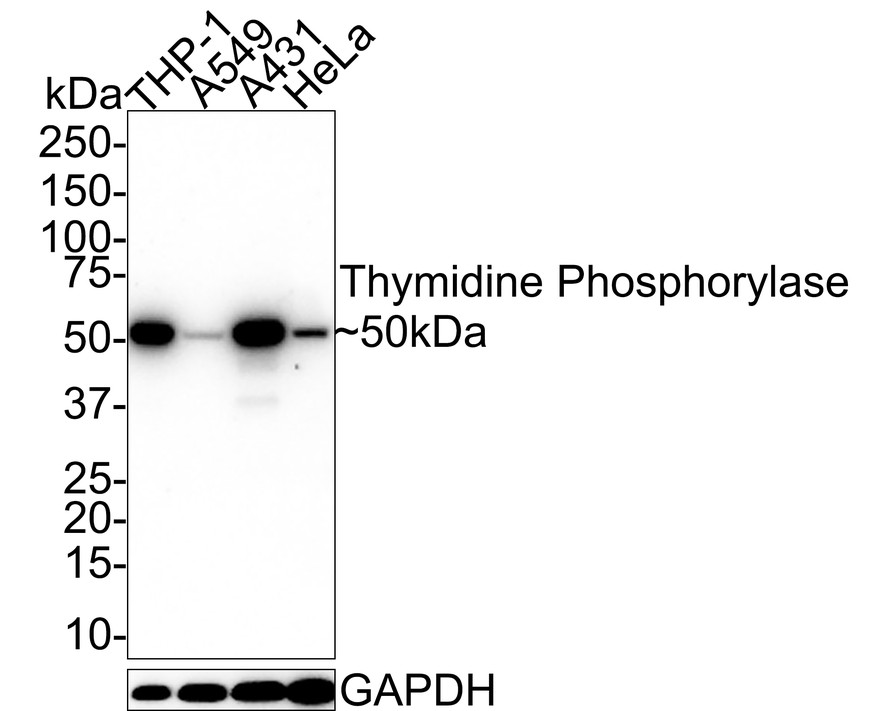 Western blot analysis of Thymidine Phosphorylase on A549 lysates. Proteins were transferred to a PVDF membrane and blocked with 5% BSA in PBS for 1 hour at room temperature. The primary antibody (EM1901-22, 1/100) was used in 5% BSA at room temperature for 2 hours. Goat Anti-Mouse IgG - HRP Secondary Antibody (HA1006) at 1:5,000 dilution was used for 1 hour at room temperature.