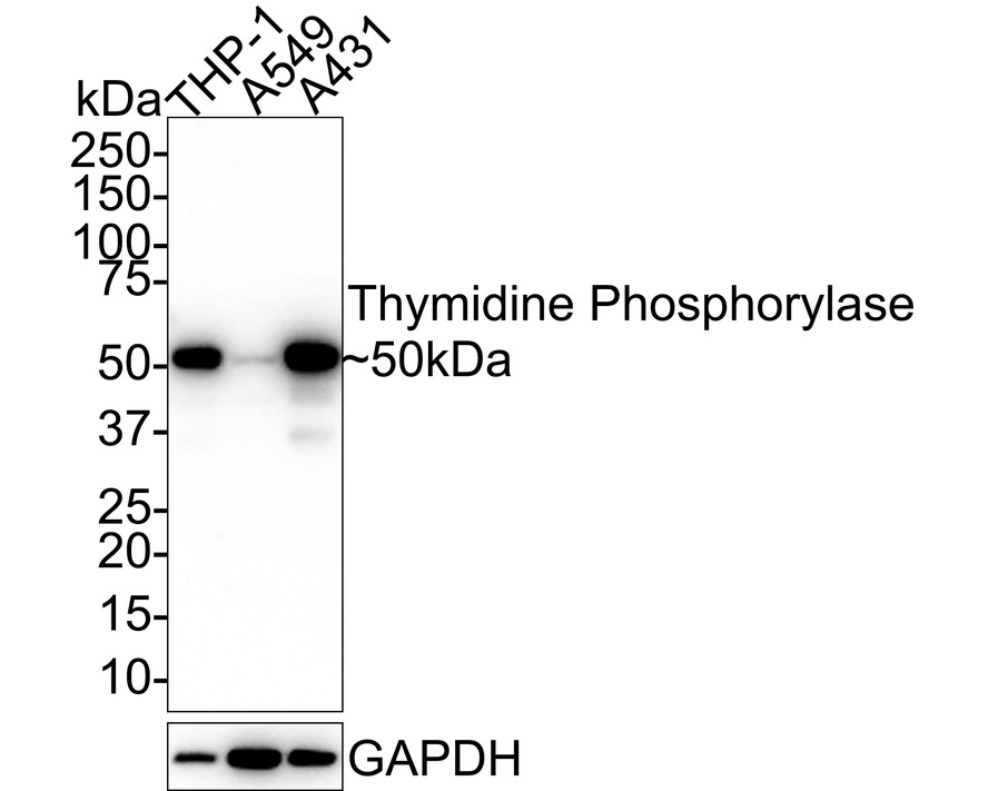 Western blot analysis of Thymidine Phosphorylase on A549 cell lysates. Proteins were transferred to a PVDF membrane and blocked with 5% BSA in PBS for 1 hour at room temperature. The primary antibody (EM1901-23, 1/100) was used in 5% BSA at room temperature for 2 hours. Goat Anti-Mouse IgG - HRP Secondary Antibody (HA1006) at 1:5,000 dilution was used for 1 hour at room temperature.