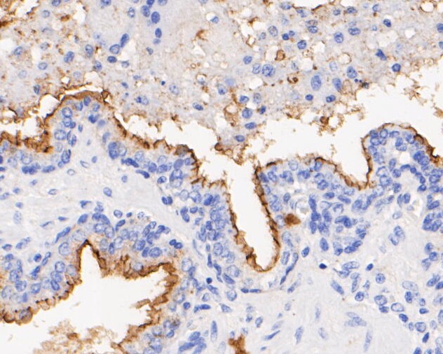 Immunohistochemical analysis of paraffin-embedded human prostate tissue using anti-CD10 antibody. The section was pre-treated using heat mediated antigen retrieval with Tris-EDTA buffer (pH 8.0-8.4) for 20 minutes.The tissues were blocked in 5% BSA for 30 minutes at room temperature, washed with ddH2O and PBS, and then probed with the primary antibody (EM1901-24, 1/200) for 30 minutes at room temperature. The detection was performed using an HRP conjugated compact polymer system. DAB was used as the chromogen. Tissues were counterstained with hematoxylin and mounted with DPX.