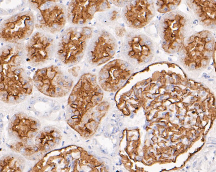 Immunohistochemical analysis of paraffin-embedded human kidney tissue using anti-CD10 antibody. The section was pre-treated using heat mediated antigen retrieval with Tris-EDTA buffer (pH 8.0-8.4) for 20 minutes.The tissues were blocked in 5% BSA for 30 minutes at room temperature, washed with ddH2O and PBS, and then probed with the primary antibody (EM1901-24, 1/800) for 30 minutes at room temperature. The detection was performed using an HRP conjugated compact polymer system. DAB was used as the chromogen. Tissues were counterstained with hematoxylin and mounted with DPX.