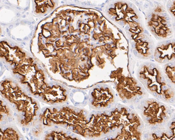 Immunohistochemical analysis of paraffin-embedded human kidney tissue using anti-CD10 antibody. The section was pre-treated using heat mediated antigen retrieval with Tris-EDTA buffer (pH 8.0-8.4) for 20 minutes.The tissues were blocked in 5% BSA for 30 minutes at room temperature, washed with ddH2O and PBS, and then probed with the primary antibody (EM1901-25, 1/800) for 30 minutes at room temperature. The detection was performed using an HRP conjugated compact polymer system. DAB was used as the chromogen. Tissues were counterstained with hematoxylin and mounted with DPX.