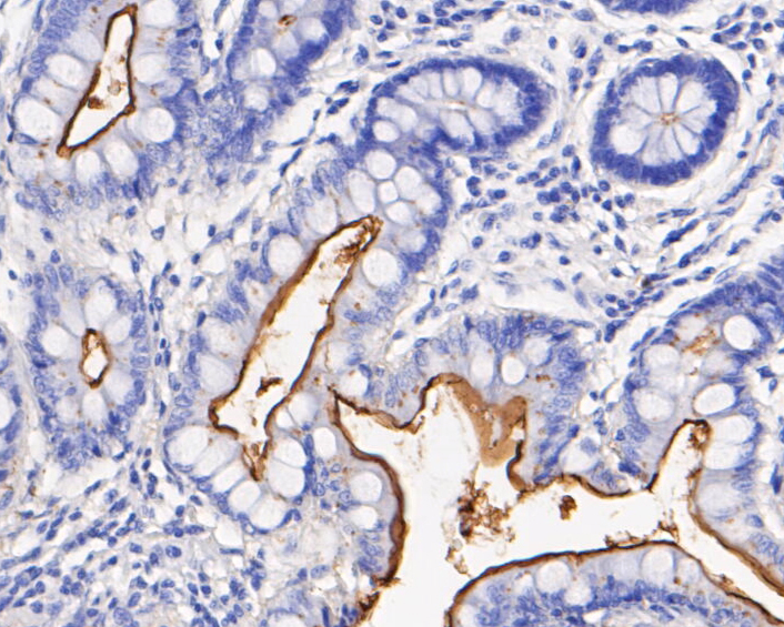 Immunohistochemical analysis of paraffin-embedded human small intestine tissue using anti-CD10 antibody. The section was pre-treated using heat mediated antigen retrieval with Tris-EDTA buffer (pH 8.0-8.4) for 20 minutes.The tissues were blocked in 5% BSA for 30 minutes at room temperature, washed with ddH2O and PBS, and then probed with the primary antibody (EM1901-25, 1/200) for 30 minutes at room temperature. The detection was performed using an HRP conjugated compact polymer system. DAB was used as the chromogen. Tissues were counterstained with hematoxylin and mounted with DPX.