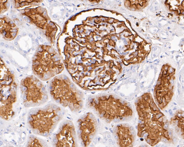 Immunohistochemical analysis of paraffin-embedded human kidney tissue using anti-CD10 antibody. The section was pre-treated using heat mediated antigen retrieval with Tris-EDTA buffer (pH 8.0-8.4) for 20 minutes.The tissues were blocked in 5% BSA for 30 minutes at room temperature, washed with ddH2O and PBS, and then probed with the primary antibody (EM1901-26, 1/800) for 30 minutes at room temperature. The detection was performed using an HRP conjugated compact polymer system. DAB was used as the chromogen. Tissues were counterstained with hematoxylin and mounted with DPX.