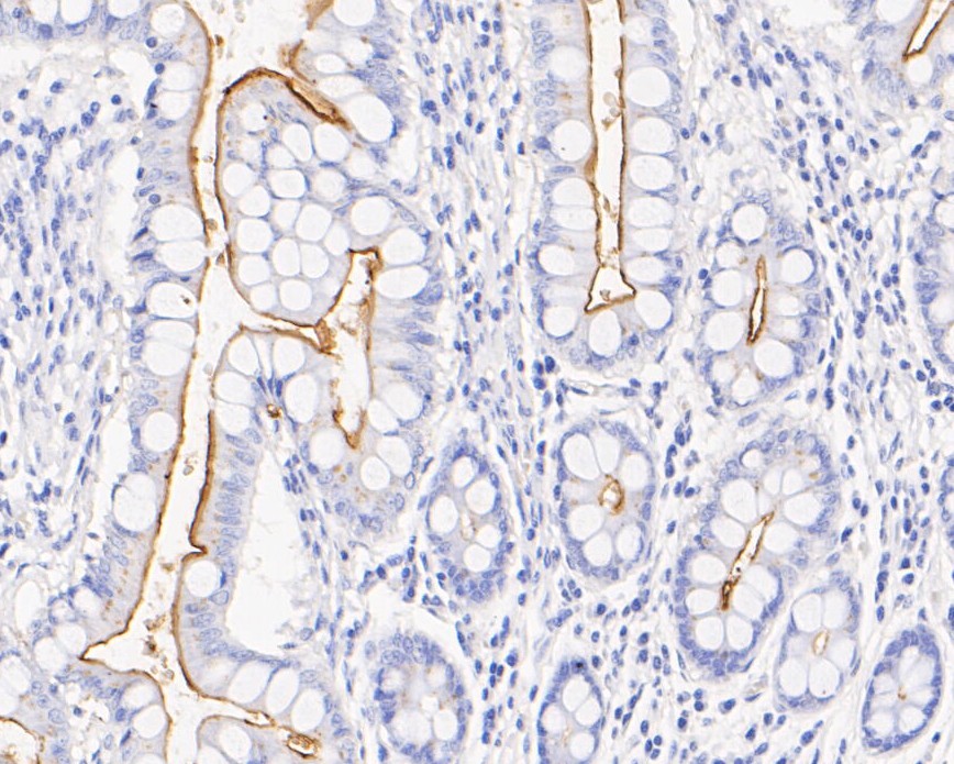 Immunohistochemical analysis of paraffin-embedded human small intestine tissue using anti-CD10 antibody. The section was pre-treated using heat mediated antigen retrieval with Tris-EDTA buffer (pH 8.0-8.4) for 20 minutes.The tissues were blocked in 5% BSA for 30 minutes at room temperature, washed with ddH2O and PBS, and then probed with the primary antibody (EM1901-26, 1/200) for 30 minutes at room temperature. The detection was performed using an HRP conjugated compact polymer system. DAB was used as the chromogen. Tissues were counterstained with hematoxylin and mounted with DPX.