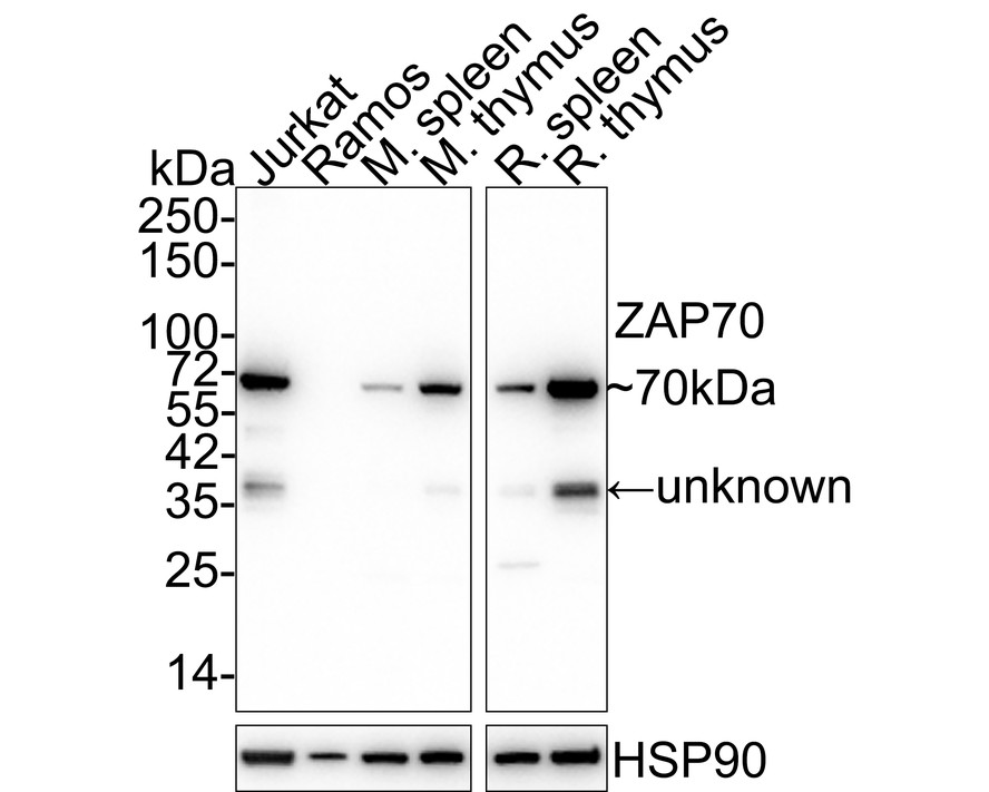 Western blot analysis of ZAP70 on Jurkat cell lysate. Proteins were transferred to a PVDF membrane and blocked with 5% BSA in PBS for 1 hour at room temperature. The primary antibody (EM1901-27, 1/500) was used in 5% BSA at room temperature for 2 hours. Goat Anti-Mouse IgG - HRP Secondary Antibody (HA1006) at 1:5,000 dilution was used for 1 hour at room temperature.