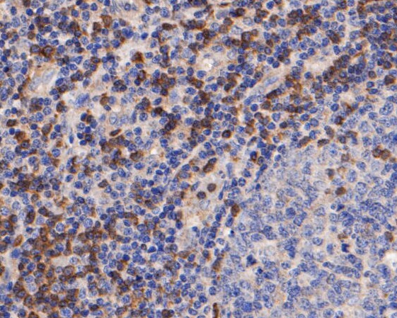 Immunohistochemical analysis of paraffin-embedded human tonsil tissue using anti-ZAP70 antibody. The section was pre-treated using heat mediated antigen retrieval with Tris-EDTA buffer (pH 8.0-8.4) for 20 minutes.The tissues were blocked in 5% BSA for 30 minutes at room temperature, washed with ddH2O and PBS, and then probed with the primary antibody (EM1901-27, 1/50) for 30 minutes at room temperature. The detection was performed using an HRP conjugated compact polymer system. DAB was used as the chromogen. Tissues were counterstained with hematoxylin and mounted with DPX.