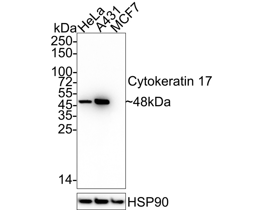 Western blot analysis of Cytokeratin 17 on SiHa cell lysate. Proteins were transferred to a PVDF membrane and blocked with 5% BSA in PBS for 1 hour at room temperature. The primary antibody (EM1901-28, 1/500) was used in 5% BSA at room temperature for 2 hours. Goat Anti-Mouse IgG - HRP Secondary Antibody (HA1006) at 1:5,000 dilution was used for 1 hour at room temperature.