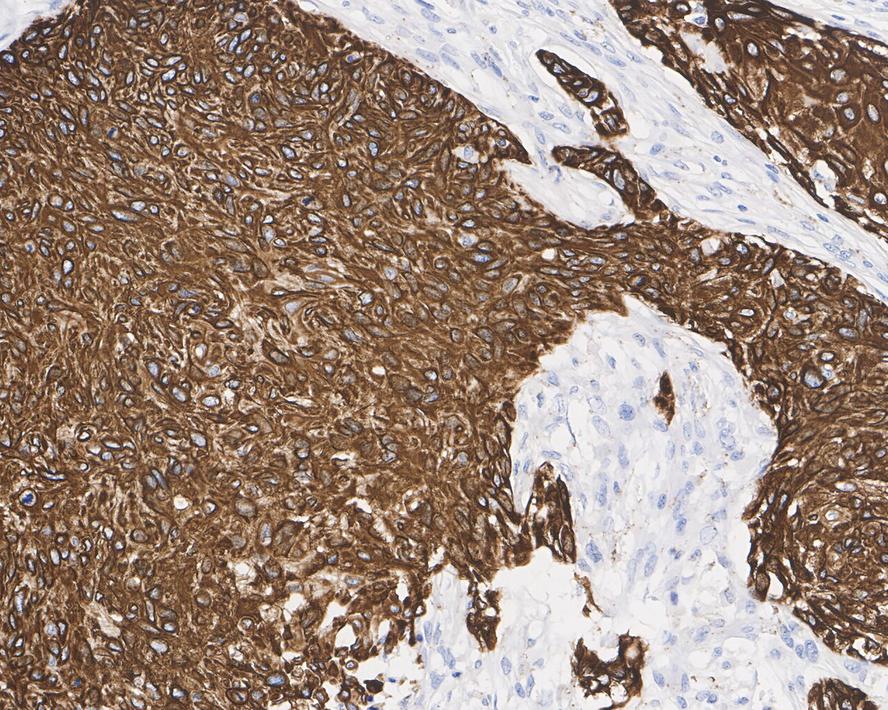 Immunohistochemical analysis of paraffin-embedded human skin tissue using anti-Cytokeratin 17 antibody. The section was pre-treated using heat mediated antigen retrieval with Tris-EDTA buffer (pH 8.0-8.4) for 20 minutes.The tissues were blocked in 5% BSA for 30 minutes at room temperature, washed with ddH2O and PBS, and then probed with the primary antibody (EM1901-29, 1/50) for 30 minutes at room temperature. The detection was performed using an HRP conjugated compact polymer system. DAB was used as the chromogen. Tissues were counterstained with hematoxylin and mounted with DPX.
