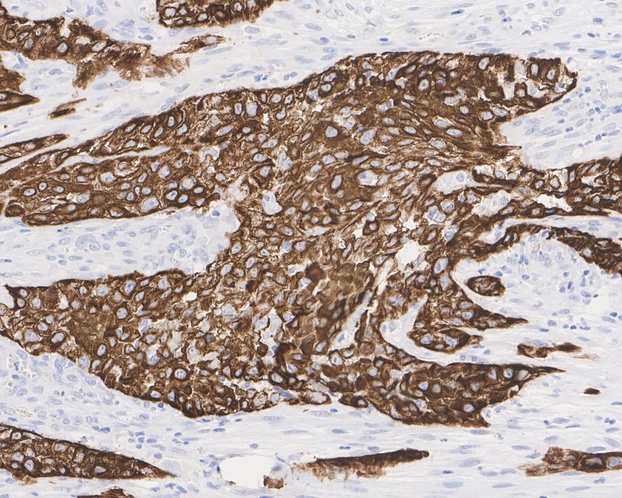 Immunohistochemical analysis of paraffin-embedded human skin tissue using anti-Cytokeratin 17 antibody. The section was pre-treated using heat mediated antigen retrieval with Tris-EDTA buffer (pH 8.0-8.4) for 20 minutes.The tissues were blocked in 5% BSA for 30 minutes at room temperature, washed with ddH2O and PBS, and then probed with the primary antibody (EM1901-29, 1/50) for 30 minutes at room temperature. The detection was performed using an HRP conjugated compact polymer system. DAB was used as the chromogen. Tissues were counterstained with hematoxylin and mounted with DPX.