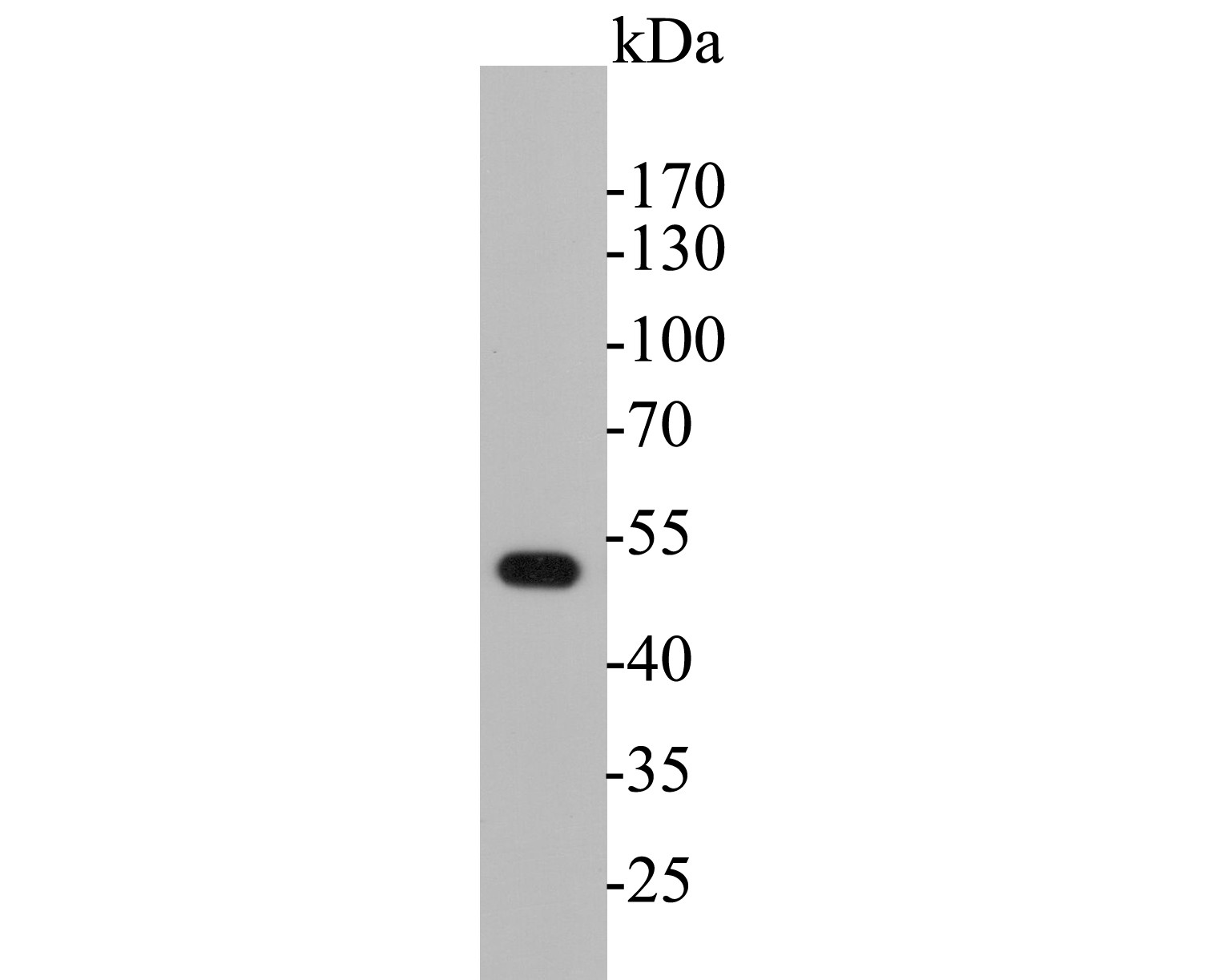 Western blot analysis of Cytokeratin 17 on SiHa cell lysate. Proteins were transferred to a PVDF membrane and blocked with 5% BSA in PBS for 1 hour at room temperature. The primary antibody (EM1901-30, 1/500) was used in 5% BSA at room temperature for 2 hours. Goat Anti-Mouse IgG - HRP Secondary Antibody (HA1006) at 1:5,000 dilution was used for 1 hour at room temperature.