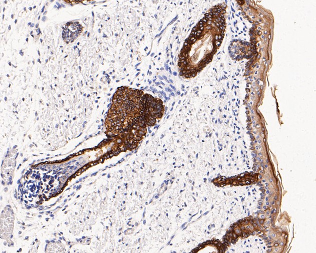 Immunohistochemical analysis of paraffin-embedded human skin tissue using anti-Cytokeratin 17 antibody. The section was pre-treated using heat mediated antigen retrieval with Tris-EDTA buffer (pH 8.0-8.4) for 20 minutes.The tissues were blocked in 5% BSA for 30 minutes at room temperature, washed with ddH2O and PBS, and then probed with the primary antibody (EM1901-30, 1/50) for 30 minutes at room temperature. The detection was performed using an HRP conjugated compact polymer system. DAB was used as the chromogen. Tissues were counterstained with hematoxylin and mounted with DPX.