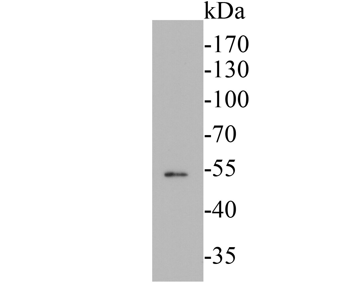 Western blot analysis of Cytokeratin 14 on A431 lysates. Proteins were transferred to a PVDF membrane and blocked with 5% BSA in PBS for 1 hour at room temperature. The primary antibody (em1901-31, 1/500) was used in 5% BSA at room temperature for 2 hours. Goat Anti-Mouse IgG - HRP Secondary Antibody (HA1006) at 1:5,000 dilution was used for 1 hour at room temperature.