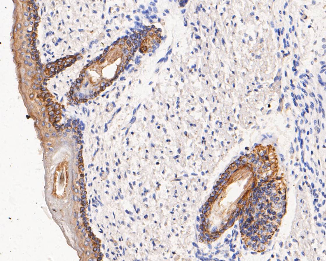 Immunohistochemical analysis of paraffin-embedded human skin tissue using anti-Cytokeratin 14 antibody. The section was pre-treated using heat mediated antigen retrieval with Tris-EDTA buffer (pH 8.0-8.4) for 20 minutes.The tissues were blocked in 5% BSA for 30 minutes at room temperature, washed with ddH2O and PBS, and then probed with the primary antibody (em1901-31, 1/200) for 30 minutes at room temperature. The detection was performed using an HRP conjugated compact polymer system. DAB was used as the chromogen. Tissues were counterstained with hematoxylin and mounted with DPX.