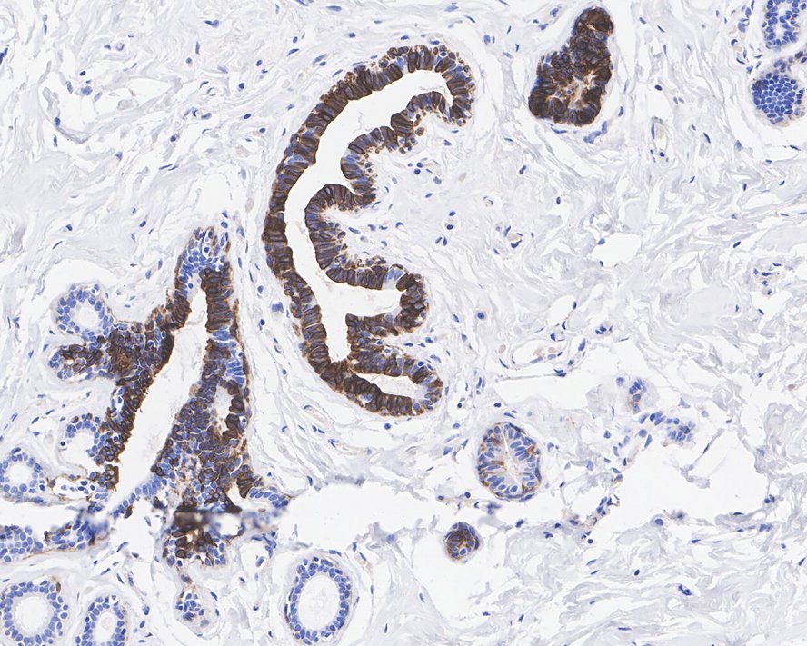 Immunohistochemical analysis of paraffin-embedded human skin tissue using anti-Cytokeratin 14 antibody. The section was pre-treated using heat mediated antigen retrieval with Tris-EDTA buffer (pH 8.0-8.4) for 20 minutes.The tissues were blocked in 5% BSA for 30 minutes at room temperature, washed with ddH2O and PBS, and then probed with the primary antibody (EM1901-33, 1/200) for 30 minutes at room temperature. The detection was performed using an HRP conjugated compact polymer system. DAB was used as the chromogen. Tissues were counterstained with hematoxylin and mounted with DPX.