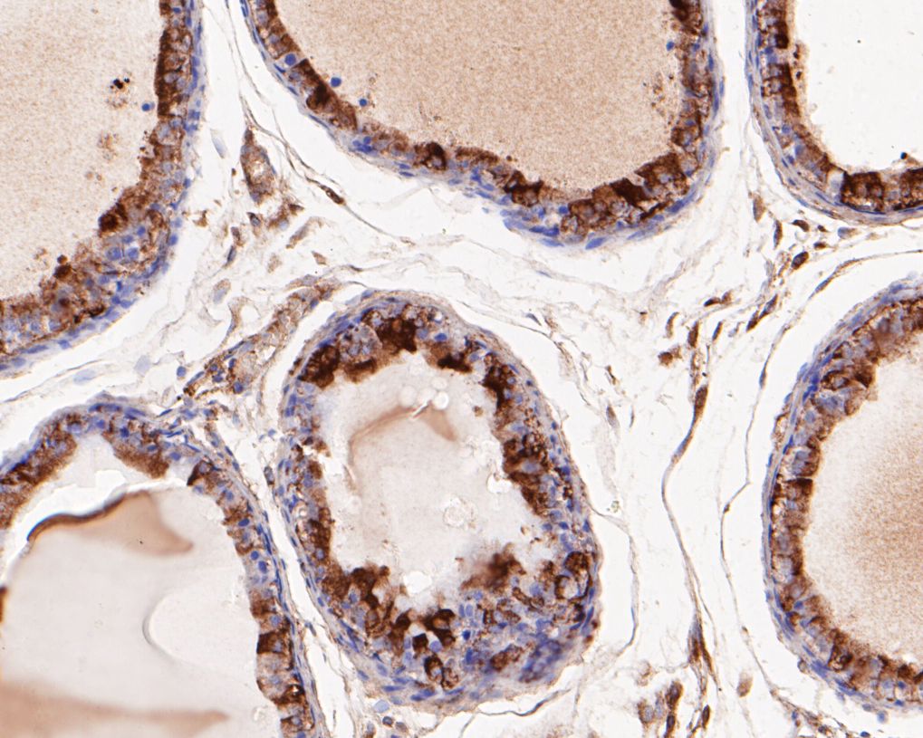 Immunohistochemical analysis of paraffin-embedded rat seminal vesicle tissue using anti-SPATA5L1 antibody. The section was pre-treated using heat mediated antigen retrieval with Tris-EDTA buffer (pH 8.0-8.4) for 20 minutes.The tissues were blocked in 5% BSA for 30 minutes at room temperature, washed with ddH2O and PBS, and then probed with the primary antibody (EM1901-35, 1/50) for 30 minutes at room temperature. The detection was performed using an HRP conjugated compact polymer system. DAB was used as the chromogen. Tissues were counterstained with hematoxylin and mounted with DPX.