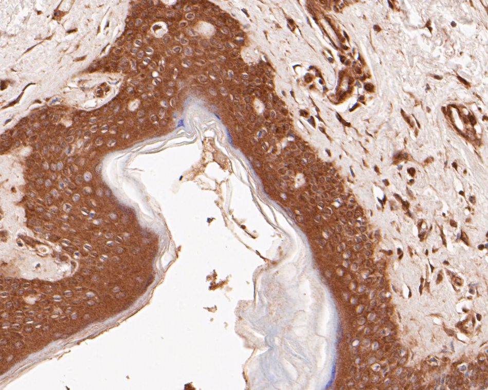 Immunohistochemical analysis of paraffin-embedded human skin tissue using anti-SPATA5L1 antibody. The section was pre-treated using heat mediated antigen retrieval with Tris-EDTA buffer (pH 8.0-8.4) for 20 minutes.The tissues were blocked in 5% BSA for 30 minutes at room temperature, washed with ddH2O and PBS, and then probed with the primary antibody (EM1901-35, 1/50) for 30 minutes at room temperature. The detection was performed using an HRP conjugated compact polymer system. DAB was used as the chromogen. Tissues were counterstained with hematoxylin and mounted with DPX.