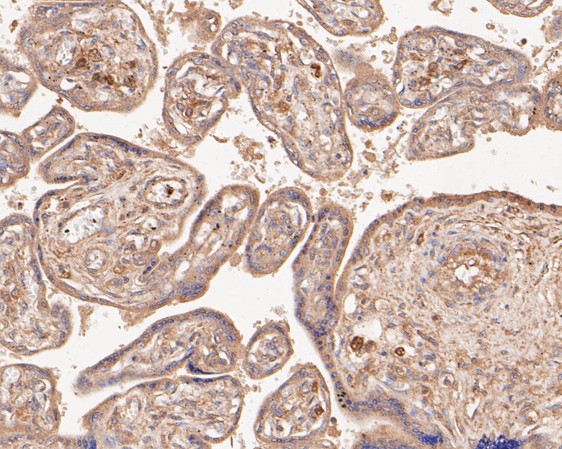 Immunohistochemical analysis of paraffin-embedded human placenta tissue using anti-SPATA5L1 antibody. The section was pre-treated using heat mediated antigen retrieval with Tris-EDTA buffer (pH 8.0-8.4) for 20 minutes.The tissues were blocked in 5% BSA for 30 minutes at room temperature, washed with ddH2O and PBS, and then probed with the primary antibody (EM1901-35, 1/50) for 30 minutes at room temperature. The detection was performed using an HRP conjugated compact polymer system. DAB was used as the chromogen. Tissues were counterstained with hematoxylin and mounted with DPX.