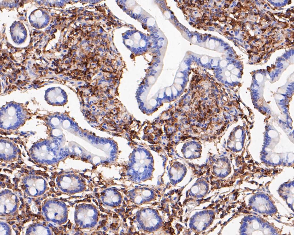 Immunohistochemical analysis of paraffin-embedded human small intestine tissue using anti-SPATA5L1 antibody. The section was pre-treated using heat mediated antigen retrieval with Tris-EDTA buffer (pH 8.0-8.4) for 20 minutes.The tissues were blocked in 5% BSA for 30 minutes at room temperature, washed with ddH2O and PBS, and then probed with the primary antibody (EM1901-35, 1/200) for 30 minutes at room temperature. The detection was performed using an HRP conjugated compact polymer system. DAB was used as the chromogen. Tissues were counterstained with hematoxylin and mounted with DPX.