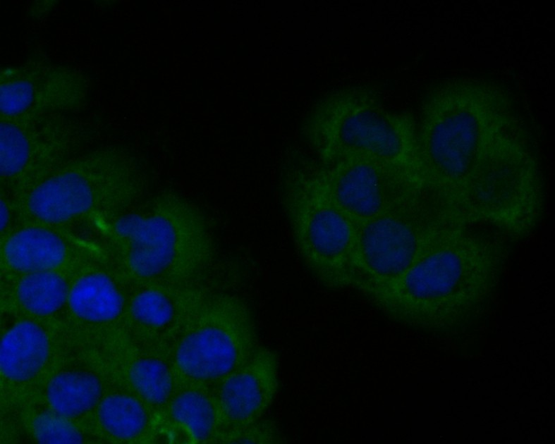 ICC staining of SPATA5L1 in JAR cells (green). Formalin fixed cells were permeabilized with 0.1% Triton X-100 in TBS for 10 minutes at room temperature and blocked with 1% Blocker BSA for 15 minutes at room temperature. Cells were probed with the primary antibody (EM1901-36, 1/50) for 1 hour at room temperature, washed with PBS. Alexa Fluor®488 Goat anti-Mouse IgG was used as the secondary antibody at 1/1,000 dilution. The nuclear counter stain is DAPI (blue).