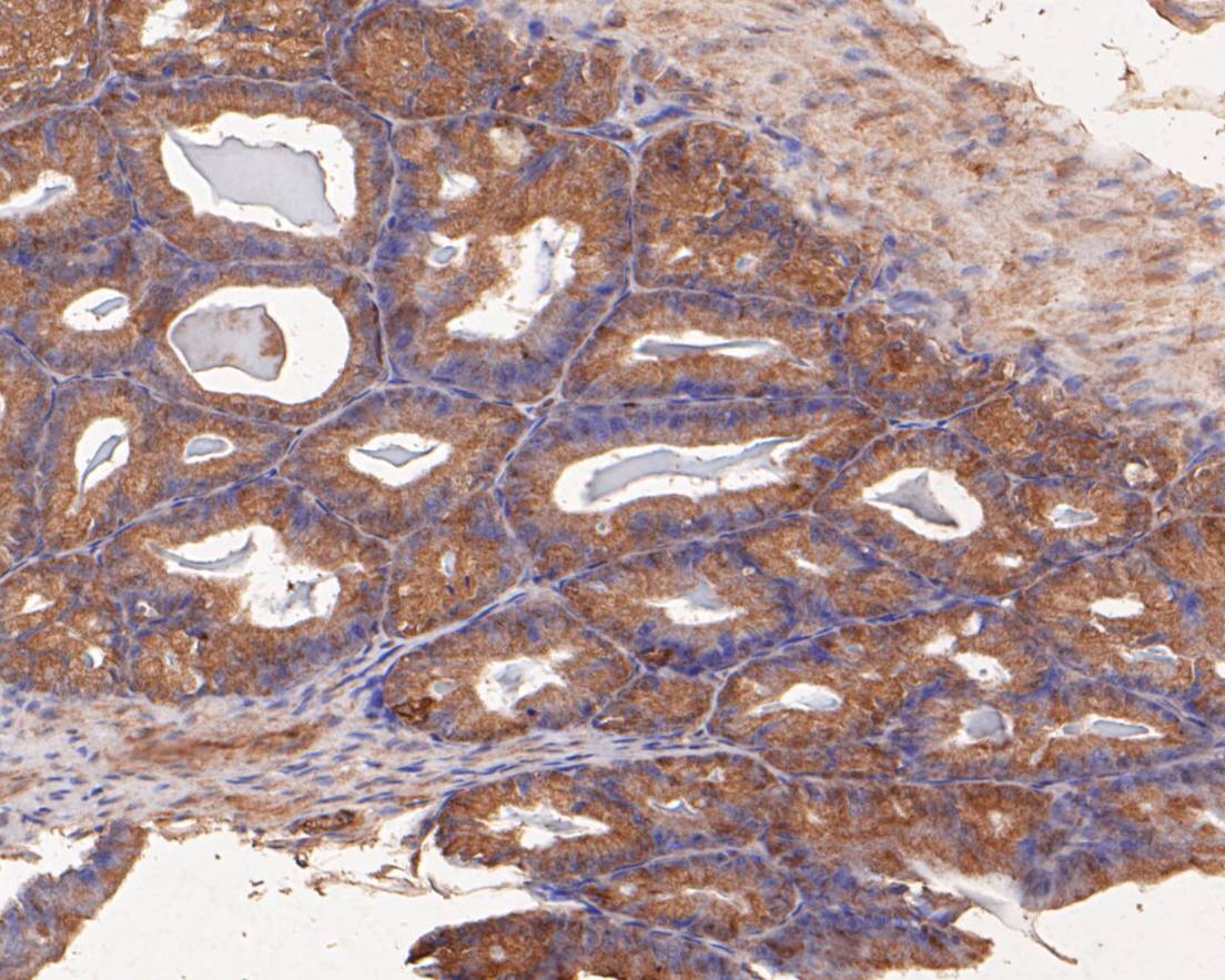 Immunohistochemical analysis of paraffin-embedded rat seminal vesicle tissue using anti-SPATA5L1 antibody. The section was pre-treated using heat mediated antigen retrieval with Tris-EDTA buffer (pH 8.0-8.4) for 20 minutes.The tissues were blocked in 5% BSA for 30 minutes at room temperature, washed with ddH2O and PBS, and then probed with the primary antibody (EM1901-36, 1/50) for 30 minutes at room temperature. The detection was performed using an HRP conjugated compact polymer system. DAB was used as the chromogen. Tissues were counterstained with hematoxylin and mounted with DPX.