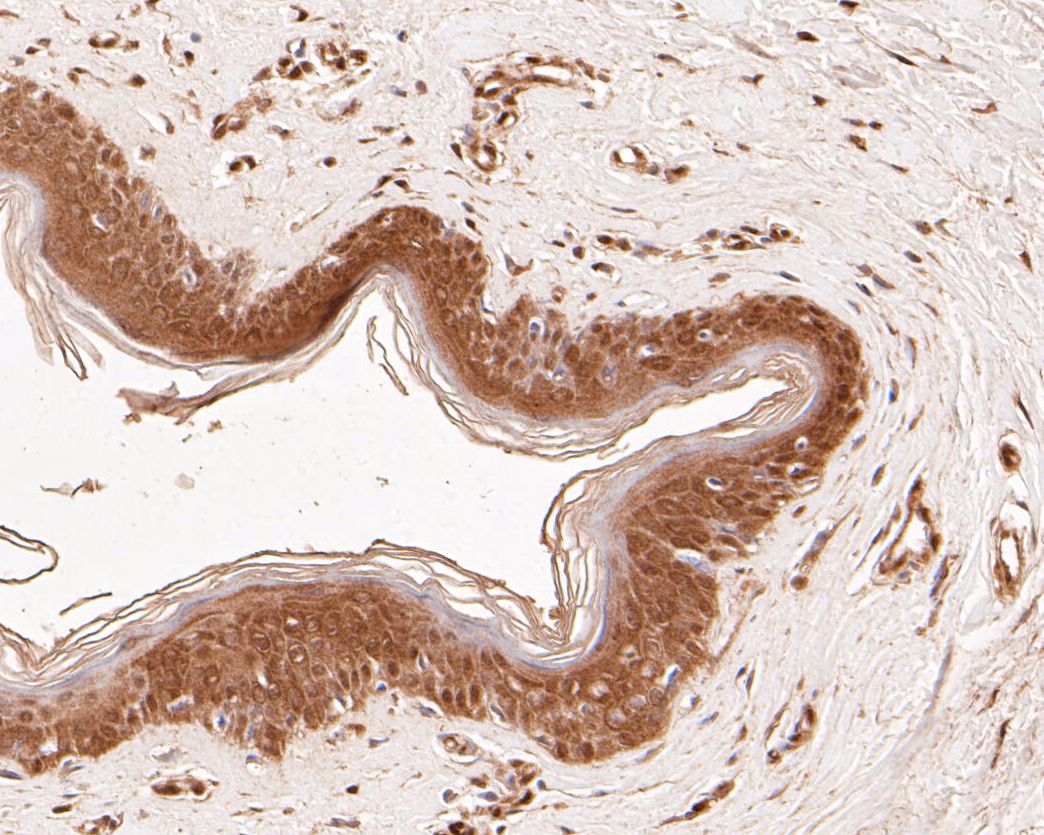 Immunohistochemical analysis of paraffin-embedded human skin tissue using anti-SPATA5L1 antibody. The section was pre-treated using heat mediated antigen retrieval with Tris-EDTA buffer (pH 8.0-8.4) for 20 minutes.The tissues were blocked in 5% BSA for 30 minutes at room temperature, washed with ddH2O and PBS, and then probed with the primary antibody (EM1901-36, 1/50) for 30 minutes at room temperature. The detection was performed using an HRP conjugated compact polymer system. DAB was used as the chromogen. Tissues were counterstained with hematoxylin and mounted with DPX.