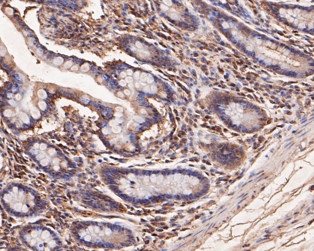 Immunohistochemical analysis of paraffin-embedded human small intestine tissue using anti-SPATA5L1 antibody. The section was pre-treated using heat mediated antigen retrieval with Tris-EDTA buffer (pH 8.0-8.4) for 20 minutes.The tissues were blocked in 5% BSA for 30 minutes at room temperature, washed with ddH2O and PBS, and then probed with the primary antibody (EM1901-36, 1/50) for 30 minutes at room temperature. The detection was performed using an HRP conjugated compact polymer system. DAB was used as the chromogen. Tissues were counterstained with hematoxylin and mounted with DPX.