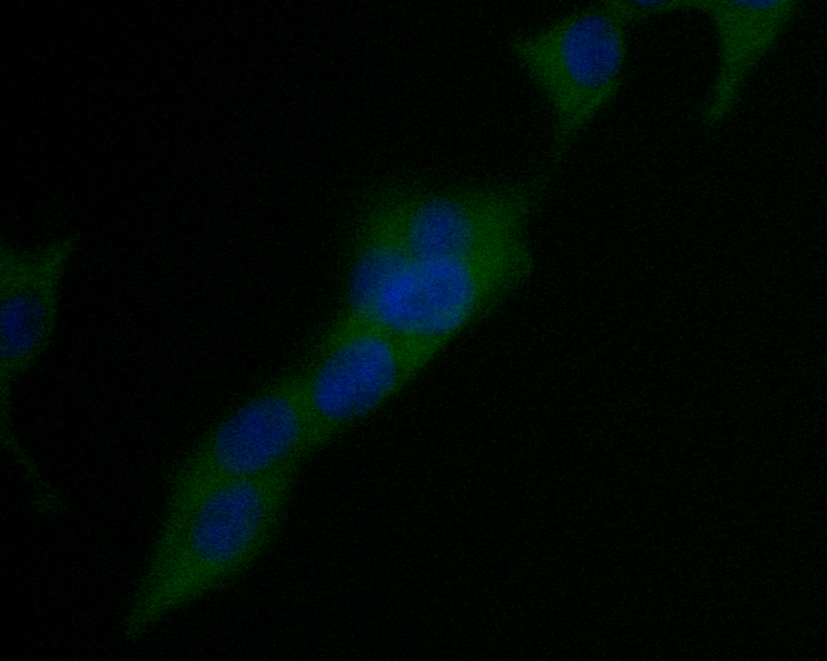 ICC staining of USP21 in 293T cells (green). Formalin fixed cells were permeabilized with 0.1% Triton X-100 in TBS for 10 minutes at room temperature and blocked with 1% Blocker BSA for 15 minutes at room temperature. Cells were probed with the primary antibody (EM1901-37, 1/50) for 1 hour at room temperature, washed with PBS. Alexa Fluor®488 Goat anti-Mouse IgG was used as the secondary antibody at 1/1,000 dilution. The nuclear counter stain is DAPI (blue).