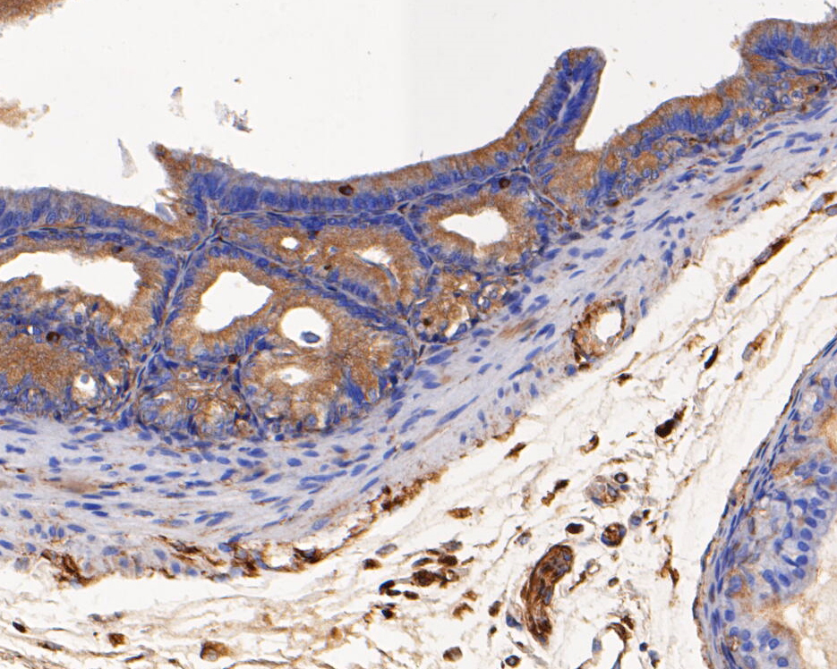 Immunohistochemical analysis of paraffin-embedded rat seminal vesicle tissue using anti-USP21 antibody. The section was pre-treated using heat mediated antigen retrieval with Tris-EDTA buffer (pH 8.0-8.4) for 20 minutes.The tissues were blocked in 5% BSA for 30 minutes at room temperature, washed with ddH2O and PBS, and then probed with the primary antibody (EM1901-37, 1/50) for 30 minutes at room temperature. The detection was performed using an HRP conjugated compact polymer system. DAB was used as the chromogen. Tissues were counterstained with hematoxylin and mounted with DPX.