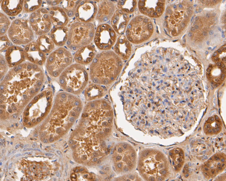 Immunohistochemical analysis of paraffin-embedded human kidney tissue using anti-USP21 antibody. The section was pre-treated using heat mediated antigen retrieval with Tris-EDTA buffer (pH 8.0-8.4) for 20 minutes.The tissues were blocked in 5% BSA for 30 minutes at room temperature, washed with ddH2O and PBS, and then probed with the primary antibody (EM1901-37, 1/50) for 30 minutes at room temperature. The detection was performed using an HRP conjugated compact polymer system. DAB was used as the chromogen. Tissues were counterstained with hematoxylin and mounted with DPX.