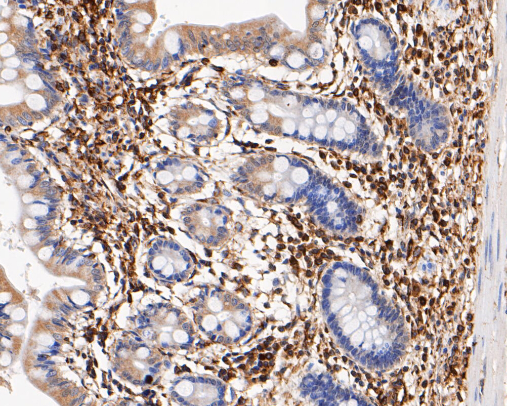 Immunohistochemical analysis of paraffin-embedded human small intestine tissue using anti-USP21 antibody. The section was pre-treated using heat mediated antigen retrieval with Tris-EDTA buffer (pH 8.0-8.4) for 20 minutes.The tissues were blocked in 5% BSA for 30 minutes at room temperature, washed with ddH2O and PBS, and then probed with the primary antibody (EM1901-37, 1/200) for 30 minutes at room temperature. The detection was performed using an HRP conjugated compact polymer system. DAB was used as the chromogen. Tissues were counterstained with hematoxylin and mounted with DPX.