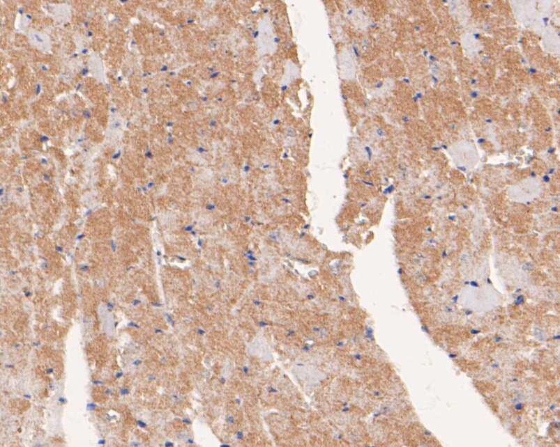 Immunohistochemical analysis of paraffin-embedded mouse heart tissue using anti-USP21 antibody. The section was pre-treated using heat mediated antigen retrieval with Tris-EDTA buffer (pH 8.0-8.4) for 20 minutes.The tissues were blocked in 5% BSA for 30 minutes at room temperature, washed with ddH2O and PBS, and then probed with the primary antibody (EM1901-37, 1/50) for 30 minutes at room temperature. The detection was performed using an HRP conjugated compact polymer system. DAB was used as the chromogen. Tissues were counterstained with hematoxylin and mounted with DPX.