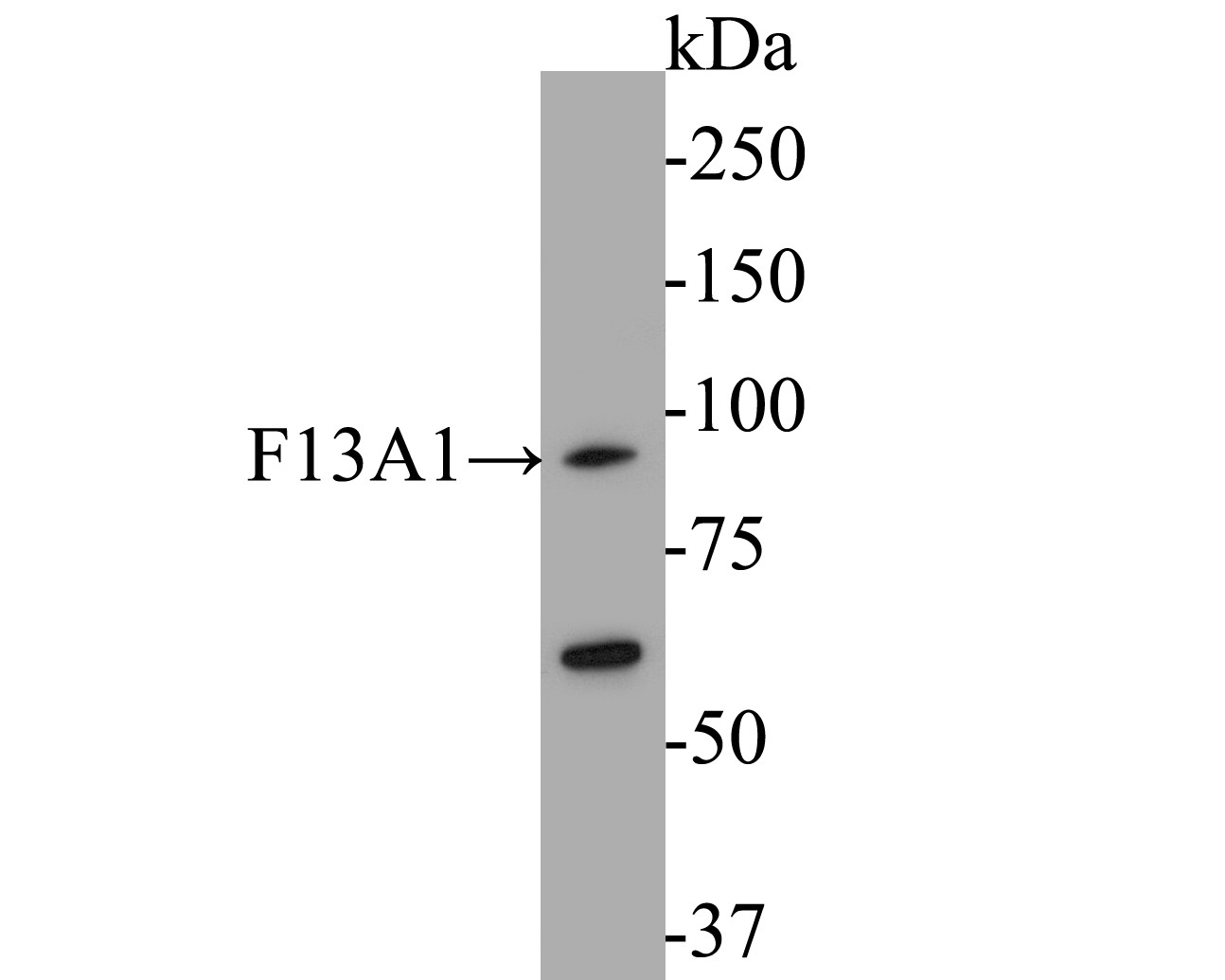 Western blot analysis of F13A1 on human placenta tissue  lysates. Proteins were transferred to a PVDF membrane and blocked with 5% BSA in PBS for 1 hour at room temperature. The primary antibody (EM1901-39, 1/500) was used in 5% BSA at room temperature for 2 hours. Goat Anti-Mouse IgG - HRP Secondary Antibody (HA1006) at 1:5,000 dilution was used for 1 hour at room temperature.