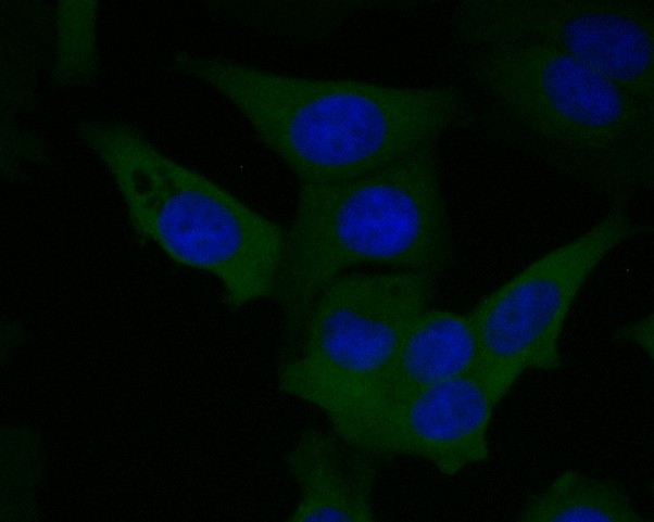 ICC staining of F13A1 in MCF-7 cells (green). Formalin fixed cells were permeabilized with 0.1% Triton X-100 in TBS for 10 minutes at room temperature and blocked with 1% Blocker BSA for 15 minutes at room temperature. Cells were probed with the primary antibody (EM1901-39, 1/50) for 1 hour at room temperature, washed with PBS. Alexa Fluor®488 Goat anti-Mouse IgG was used as the secondary antibody at 1/1,000 dilution. The nuclear counter stain is DAPI (blue).