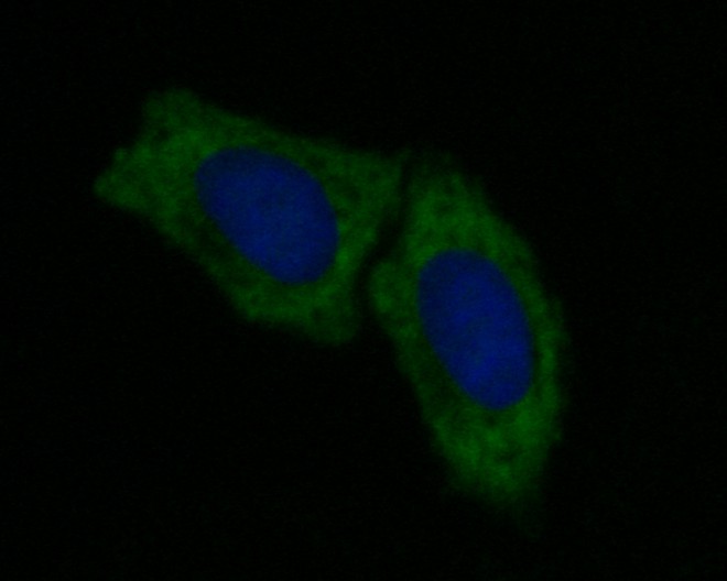 ICC staining of CD40 in SiHa cells (green). Formalin fixed cells were permeabilized with 0.1% Triton X-100 in TBS for 10 minutes at room temperature and blocked with 1% Blocker BSA for 15 minutes at room temperature. Cells were probed with the primary antibody (EM1901-40, 1/50) for 1 hour at room temperature, washed with PBS. Alexa Fluor®488 Goat anti-Mouse IgG was used as the secondary antibody at 1/1,000 dilution. The nuclear counter stain is DAPI (blue).