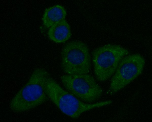 ICC staining of CD40 in SKOV-3 cells (green). Formalin fixed cells were permeabilized with 0.1% Triton X-100 in TBS for 10 minutes at room temperature and blocked with 1% Blocker BSA for 15 minutes at room temperature. Cells were probed with the primary antibody (EM1901-40, 1/50) for 1 hour at room temperature, washed with PBS. Alexa Fluor®488 Goat anti-Mouse IgG was used as the secondary antibody at 1/1,000 dilution. The nuclear counter stain is DAPI (blue).