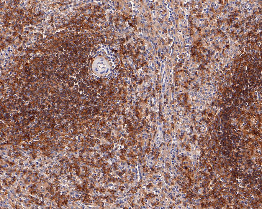 Immunohistochemical analysis of paraffin-embedded human spleen tissue with Mouse anti-CD40 antibody (EM1901-41) at 1/200 dilution.<br />
<br />
The section was pre-treated using heat mediated antigen retrieval with Tris-EDTA buffer (pH 9.0) for 20 minutes. The tissues were blocked in 1% BSA for 20 minutes at room temperature, washed with ddH2O and PBS, and then probed with the primary antibody (EM1901-41) at 1/200 dilution for 1 hour at room temperature. The detection was performed using an HRP conjugated compact polymer system. DAB was used as the chromogen. Tissues were counterstained with hematoxylin and mounted with DPX.