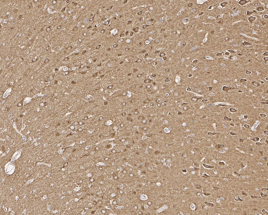 Immunohistochemical analysis of paraffin-embedded mouse brain tissue using anti-Dynamin 1 antibody. The section was pre-treated using heat mediated antigen retrieval with Tris-EDTA buffer (pH 8.0-8.4) for 20 minutes.The tissues were blocked in 5% BSA for 30 minutes at room temperature, washed with ddH2O and PBS, and then probed with the primary antibody (EM1901-42, 1/50) for 30 minutes at room temperature. The detection was performed using an HRP conjugated compact polymer system. DAB was used as the chromogen. Tissues were counterstained with hematoxylin and mounted with DPX.