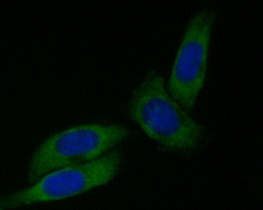 ICC staining of Dynamin 1 in SiHa cells (green). Formalin fixed cells were permeabilized with 0.1% Triton X-100 in TBS for 10 minutes at room temperature and blocked with 1% Blocker BSA for 15 minutes at room temperature. Cells were probed with the primary antibody (EM1901-44, 1/50) for 1 hour at room temperature, washed with PBS. Alexa Fluor®488 Goat anti-Mouse IgG was used as the secondary antibody at 1/1,000 dilution. The nuclear counter stain is DAPI (blue).