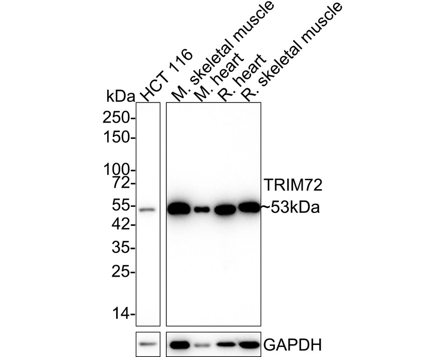 Western blot analysis of TRIM72 on HCT116 cell lysates with Mouse anti-TRIM72 antibody (EM1901-45) at 1/500 dilution.<br />
<br />
Lysates/proteins at 10 µg/Lane.<br />
<br />
Predicted band size: 53 kDa<br />
Observed band size: 53 kDa<br />
<br />
Exposure time: 1 minute;<br />
<br />
10% SDS-PAGE gel.<br />
<br />
Proteins were transferred to a PVDF membrane and blocked with 5% NFDM/TBST for 1 hour at room temperature. The primary antibody (EM1901-45) at 1/500 dilution was used in 5% NFDM/TBST at room temperature for 2 hours. Goat Anti-Mouse IgG - HRP Secondary Antibody (HA1006) at 1:100,000 dilution was used for 1 hour at room temperature.